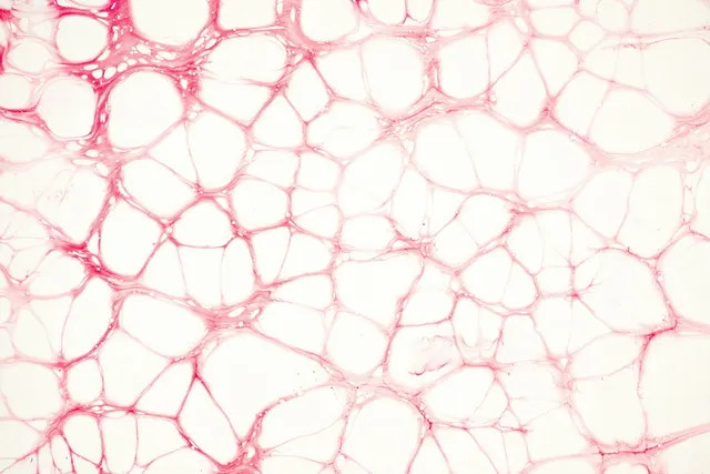 A pink network of rounded cells on a white ground